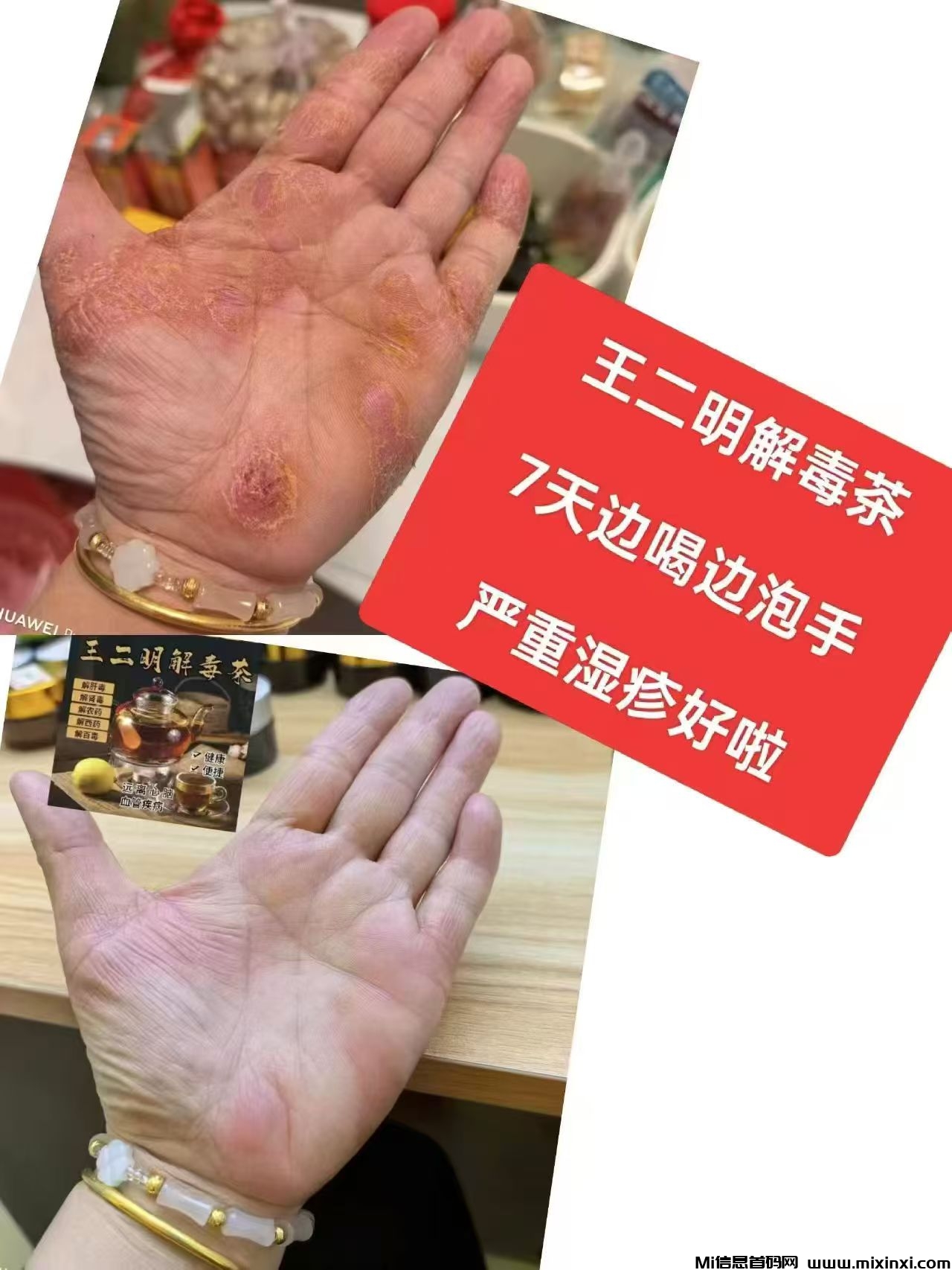传承中医大健康事业管道收益