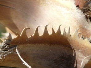 世界上最恶心的病是什么病?,世界上最恶劣的病